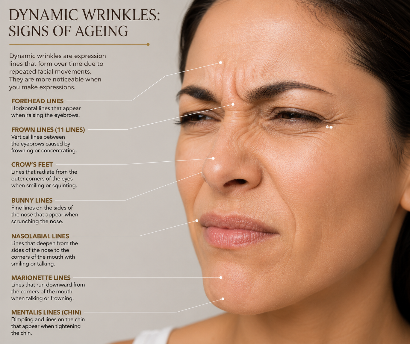Dynamic wrinkles — On movement