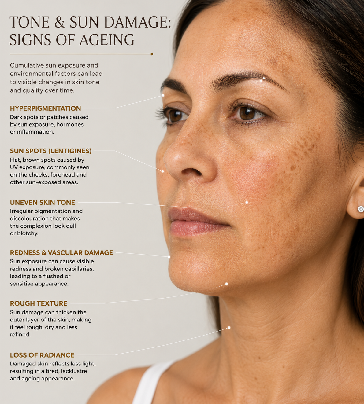 Tone & sun damage — Surface pigment