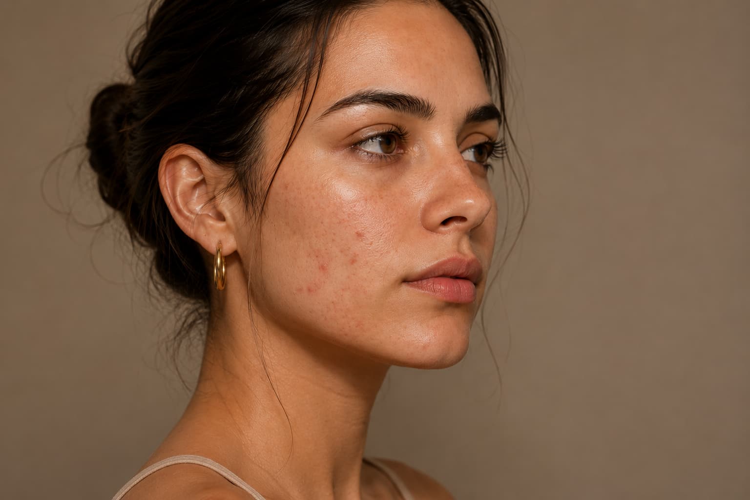 Case 02 · Before — daylight, no concealer