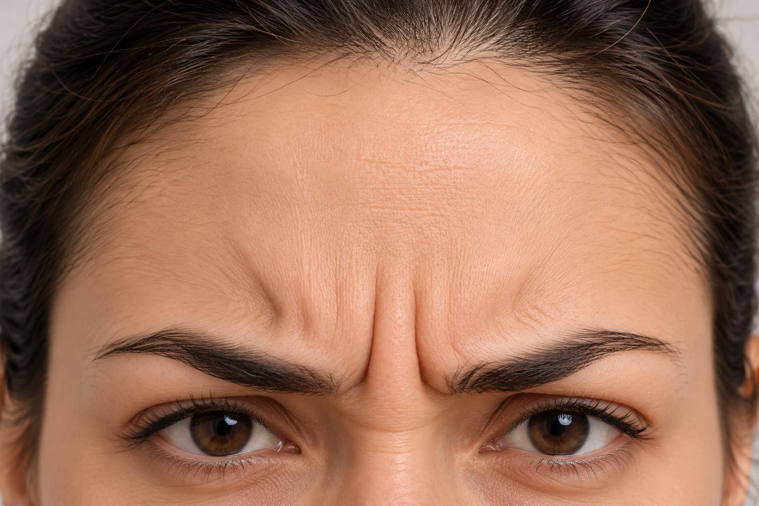 Botox treatment for frown lines