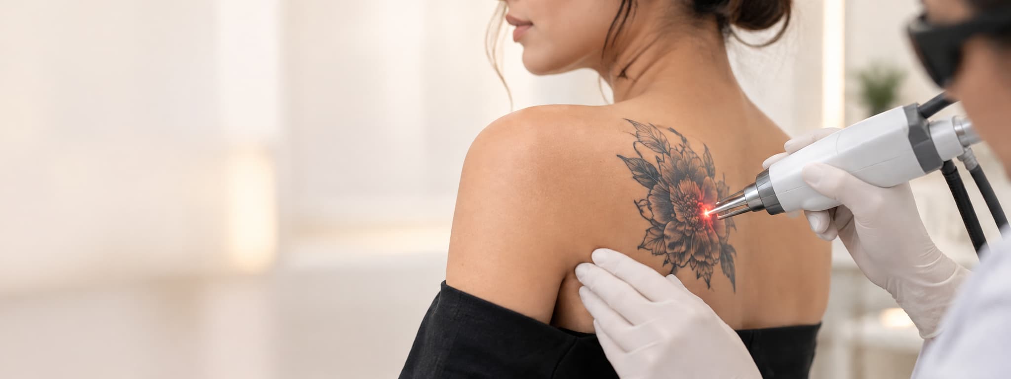 Tattoo removal treatment at dermatologist clinic